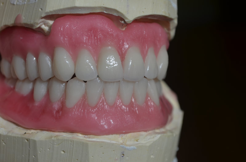 Are my dentures ugly?