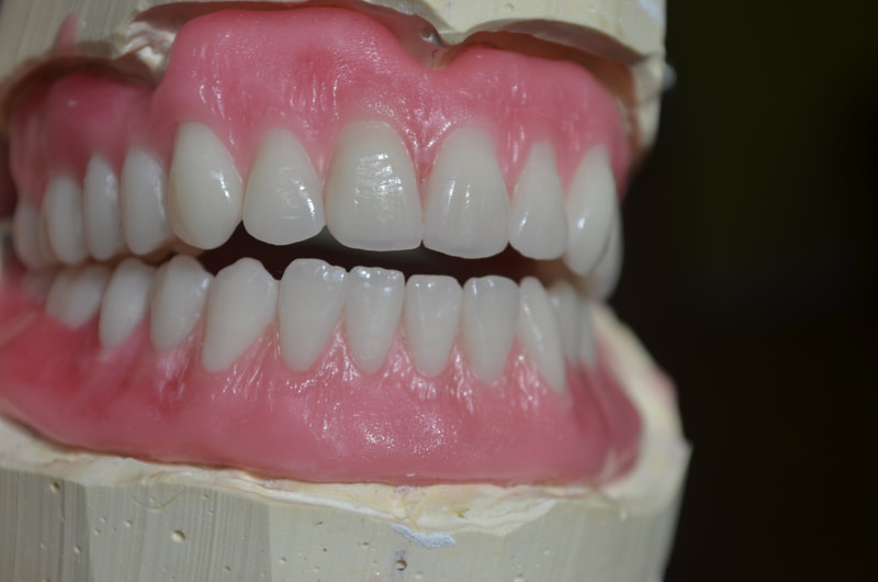 Dentures in Mississauga